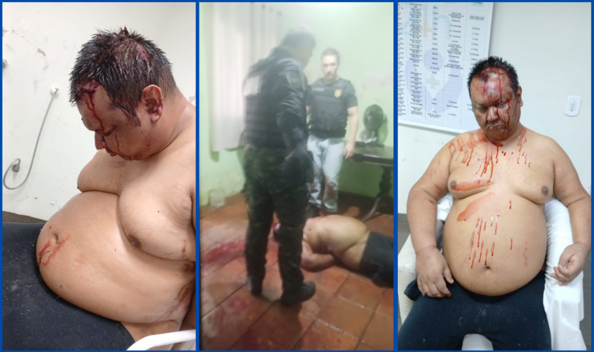 A vítima sofreu afundamento de crânio e segue hospitalizada. A irmã dele, com sequelas de AVC, também foi agredida. Os policiais alegaram ter sido atacados, mas familiares afirmam que não houve agressão e que os agentes se recusaram a mostrar o mandado.